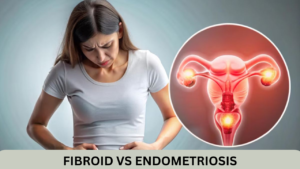 Fibroid vs Endometriosis: Symptoms, Causes & Treatment in Aundh