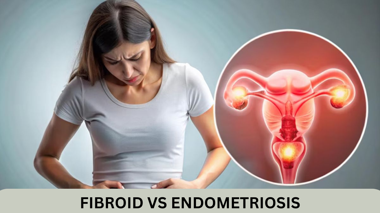 Fibroid vs Endometriosis: Symptoms, Causes & Treatment in Aundh